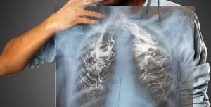 ADVIERTE IPEBC SOBRE RIESGOS POR CONSUMO DE TABACO Y SU RELACIÓN CON PADECIMIENTOS DE SALUD MENTAL